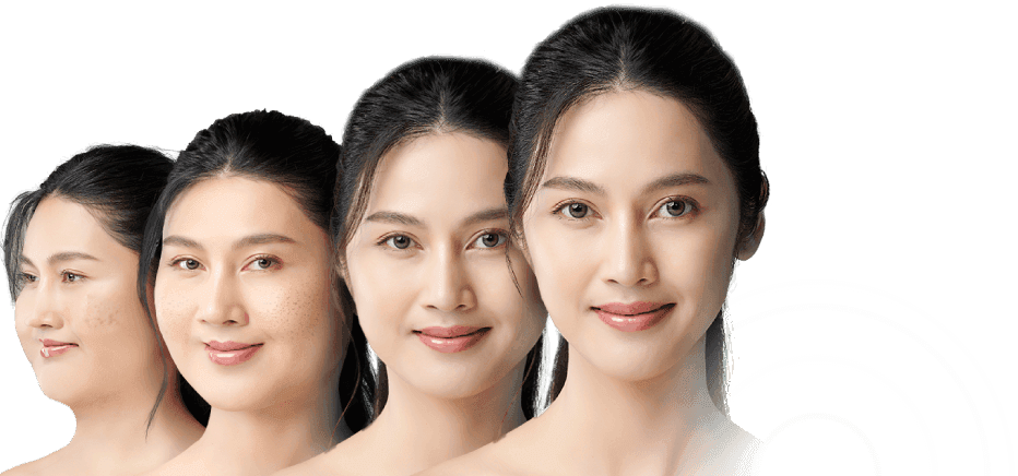 #PilihYangLebih Bikin Ramping dengan Nge-gym di FIT HUB, Tanpa Efek Samping!